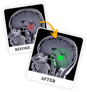 Billionaire Brain Wave-smartoffereviews.com-UNITEDSTATESAMERICA-USA